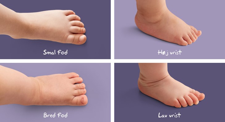 Bandit perle Pigment Babyfødder er forskellige | Sådan passer du på dit barns fødder | Skoringen